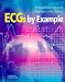 Books : ECG's by Example