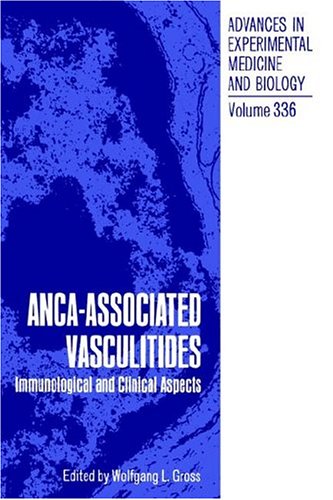 Vasculitis