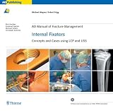 Internal Fixators: Concepts and Cases using LCP and LISS