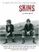 Skins