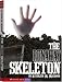 The Runaway Skeleton (Stone Arch Mystery)