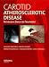 Books : Carotid Atherosclerotic Disease: Pathologic Basis for Treatment