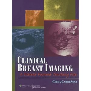 Click here to buy Clinical Breast Imaging: A Patient Focused Teaching File (LWW Teaching File... by Gilda Cardenosa.