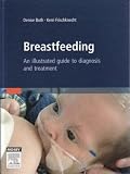 Breastfeeding: An Illustrated Guide To Diagnosis and Treatment