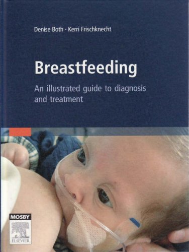 breastfeeding an illustrated guide to diagnosis and treatment