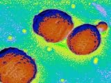 Gram Bacteria Streptococcus Pneumoniae Photographic Poster Print, 32x24