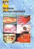 Skin diseases after organ transplantation