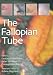 The Fallopian Tube