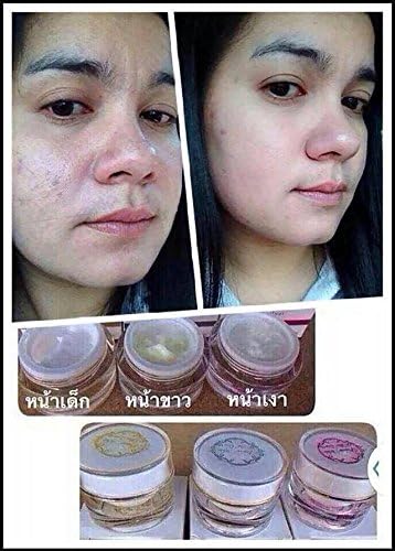 12 Sets X Result Within7days. Princess Skin Care Whitening Acne Cream, Baby Face,aura Face,white Face 10g.