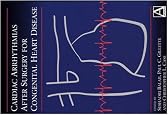Cardiac Arrhythmias After Surgery for Congenital Heart Disease
