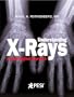Understanding X-Rays: A Plain English Approach