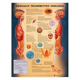 Sexually Transmitted Diseases Poster