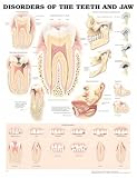 Disorders of the Teeth and Jaw Anatomical Chart