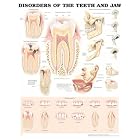 Disorders of the Teeth and Jaw Anatomical Chart by Anatomical Chart Company