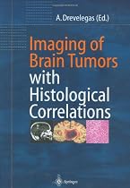 Imaging of Brain Tumors with Histological Correlations
