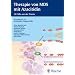Therapie von MDS mit Azacitidin