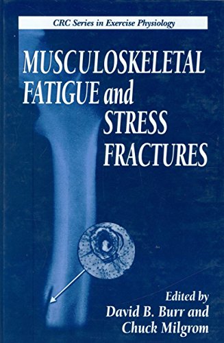 Musculoskeletal Fatigue and Stress Fractures (Exercise Physiology)