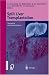 Split Liver transplantation: Theoretical and practical aspects