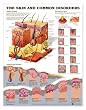 Skin and Common Disorders Anatomical Chart Unmounted