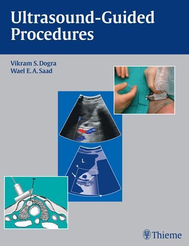Ultrasound-Guided Procedures Paperback October 28, 2009