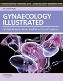 Gynaecology illustrated
