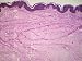 Black Skin African Epidermis X100 Photographic Poster Print, 16x12