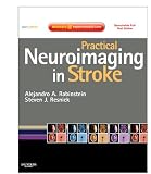 Practical Neuroimaging in Stroke: A Case-Based Approach