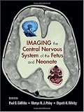 Imaging the Central Nervous System of the Fetus and Neonate