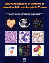 WHO Classification of Tumours of Haematopoietic and Lymphoid Tissue (IARC WHO Classification of Tumours)
