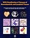 WHO Classification of Tumours of Haematopoietic and Lymphoid Tissue (IARC WHO Classification of Tumours)