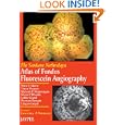 The Sankara Nethralaya Atlas of Fundus Fluorescein Angiography by Shetty