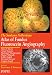 Atlas of Fundus Fluorescein Angiography