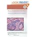 Biopsy Interpretation of the Skin: Primary Non-Lymphoid Neoplasms of the Skin (Biopsy Interpretation Series)