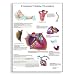 3B Scientific Glossy Paper Common Cardiac Disorders Anatomical Chart