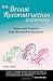 The Breast Reconstruction Guidebook, Second Edition