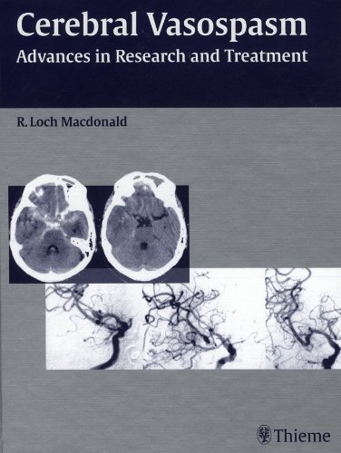 Cerebral Vasospasm: Advances in Research and Treatment On Sale