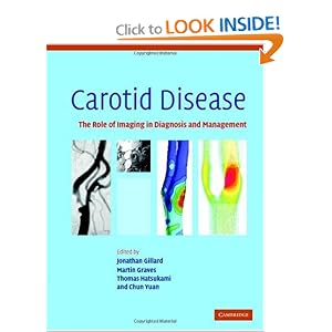 Click here to buy Carotid Disease: The Role of Imaging in Diagnosis and Management by Jonathan Gillard, Martin Graves, Thomas Hatsukami, and Chun Yuan.