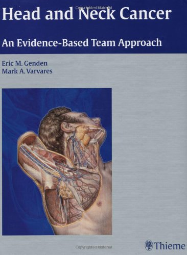 head and neck cancer an evidence based team approach