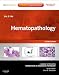 Hematopathology: A Volume in Foundations in Diagnostic Pathology Series (Expert Consult - Online and Print), 2e