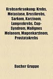 Bild zu: Krebserkrankung: Krebs, Metastase, Brustkrebs, Sarkom, Karzinom, Lungenkrebs, Cup-Syndrom, Malignes Melanom, Magenkarzinom, Prostatakre