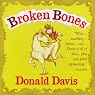 Broken Bones