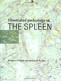 Illustrated Pathology of the Spleen