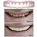 Natural Imako Cosmetic Teeth, size Small