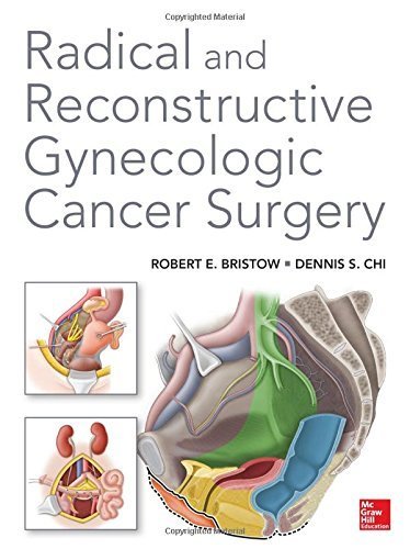 Radical and Reconstructive Gynecologic Cancer Surgery by Robert Bristow (2014-12-23)