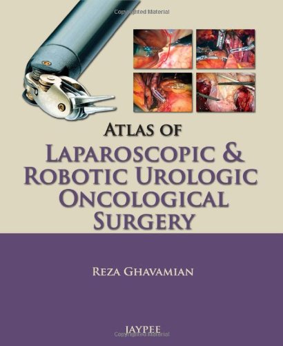 atlas of laparoscopic and robotic urologic oncological surgery