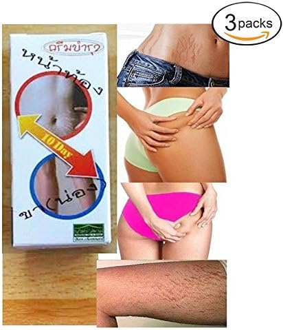 3 UNITS of THE BEST STRETCH MARK REMOVAL CREAM REDUCER SCAR TREATMENT[Get Free Tomato Facial Mask &amp; Ceramine UV Line Ginkgo Plus Whitening Cream 8.50ml.]