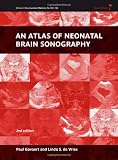 An Atlas of Neonatal Brain Sonography (Clinics in Developmental Medicine)