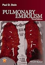 Pulmonary Embolism Pulmonary Embolism