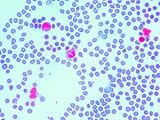 Bone Marrow Micrograph Normal Blood Cell Maturing Photographic Poster Print, 32x24