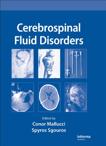 Cerebrospinal Fluid Disorders On Sale